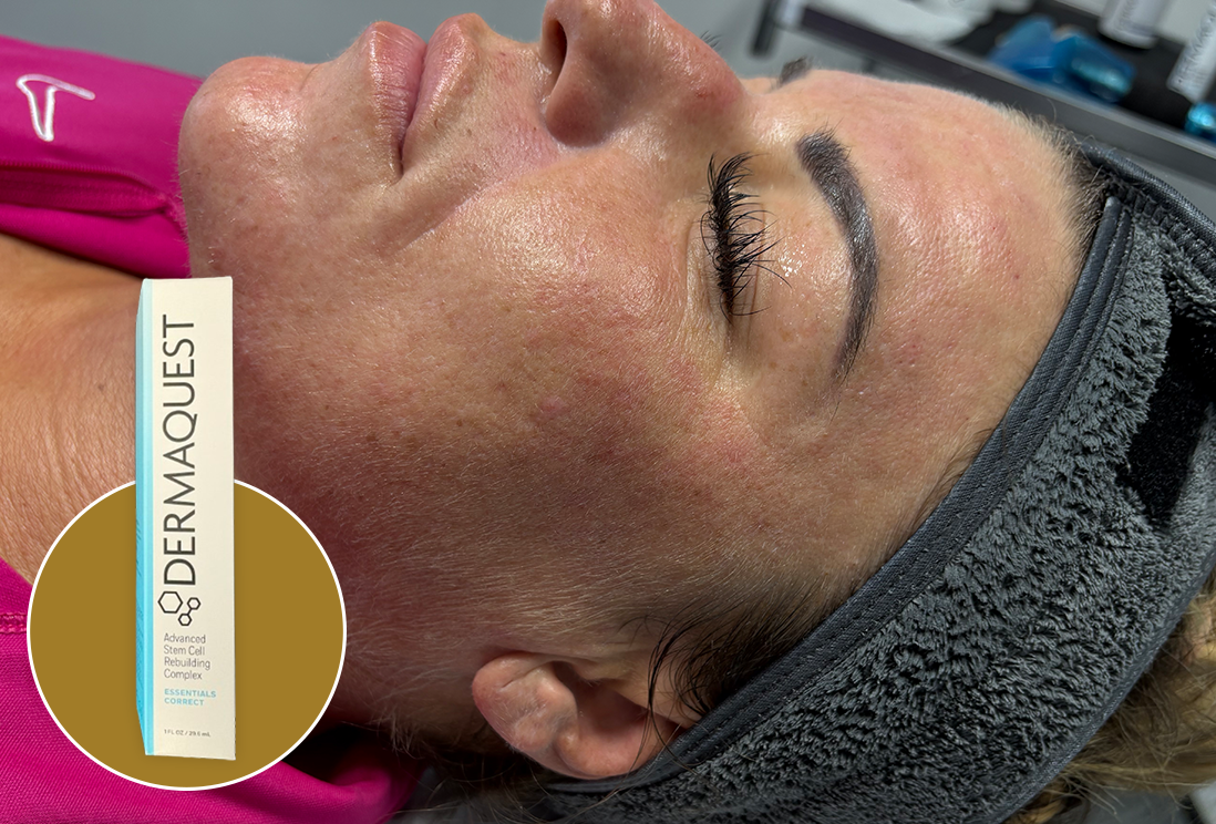 derma-stem-glow